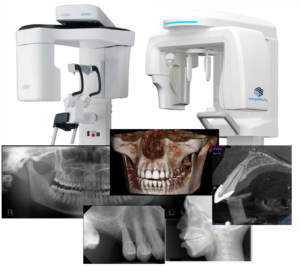 Imageworks Panoura 18S panoramic dental x-ray machine