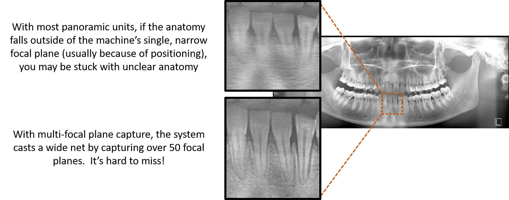 digital dental panoramic x-ray machine