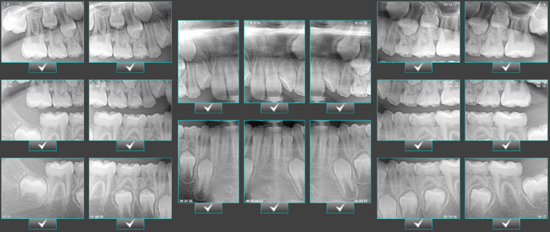 Digital dental panoramic x-ray machine bite wings